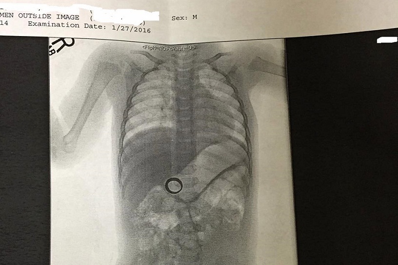 Изгубили венчани прстен, а када су га пронашли уопште се нису радовали (ФОТО)
